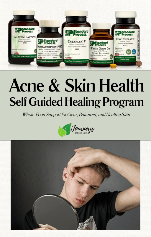 Acne and Healthy Skin Self Guided Healing Program PDF for Clear Skin ...